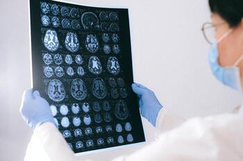 Los neurólogos piden un nuevo abordaje de la Esclerosis Múltiple